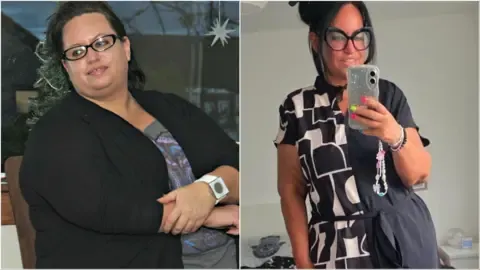 They Shed Pounds Using Shots – Then Came the Excess Skin